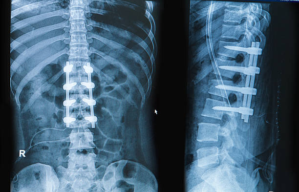 Best Advanced Spine Surgeon in Seawoods, Navi Mumbai